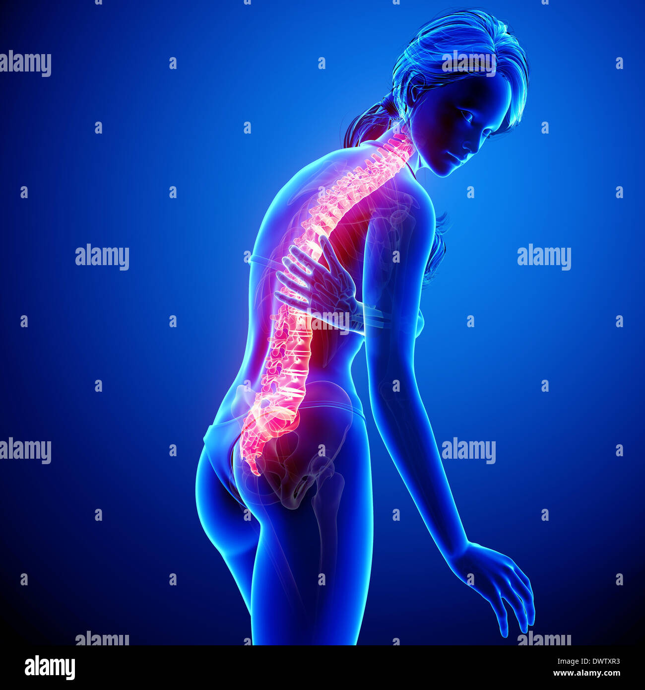 Back Problem Woman Diagram Back pain woman drawing Stock Photo - Alamy