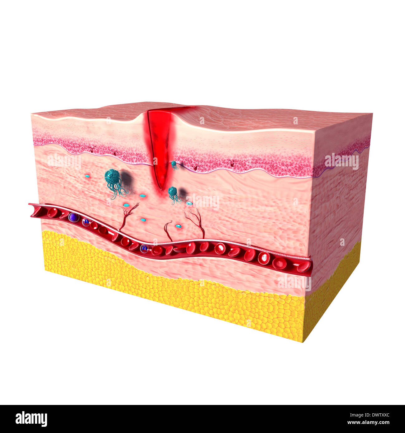 Healing wound drawing Stock Photo Alamy