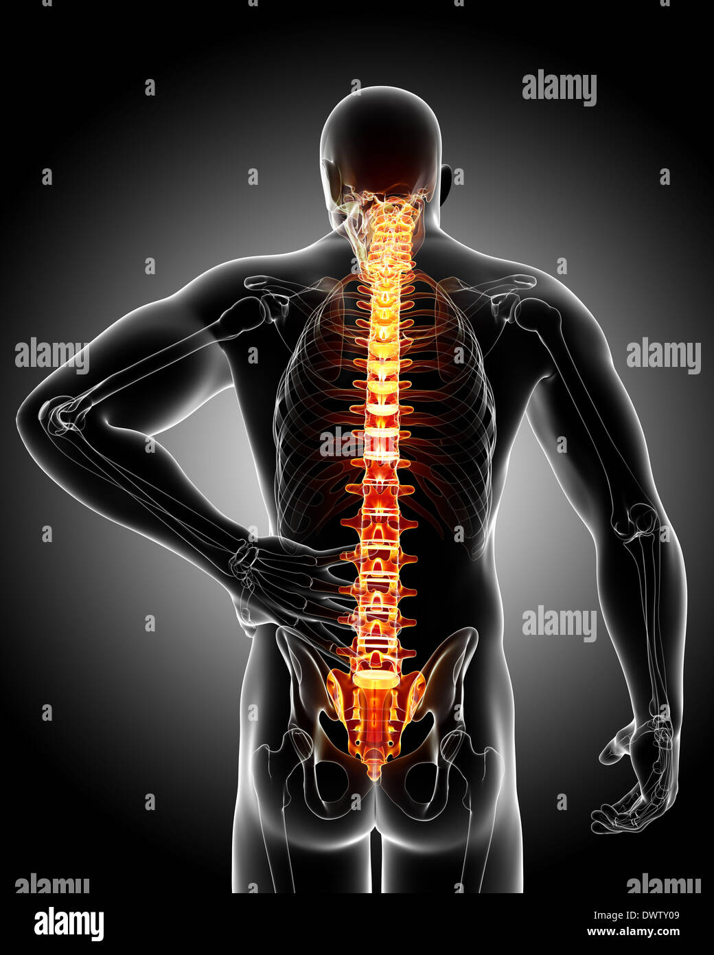 Болит спина. It can back. Types of scoliosis. Боль св сине. Спина позвоночник.