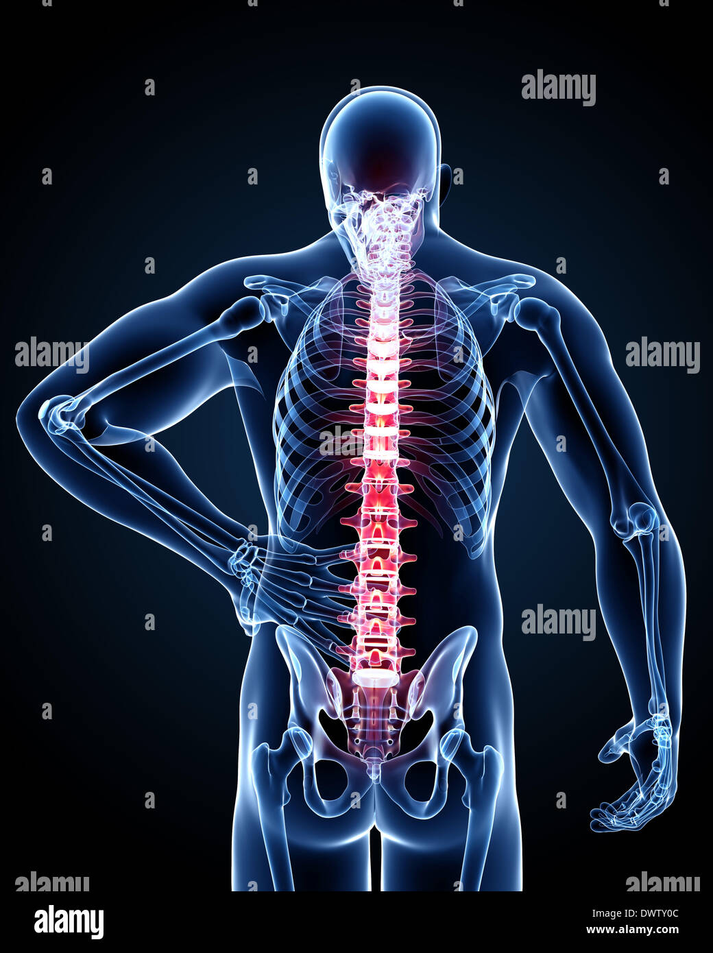 Back pain man drawing Stock Photo Alamy