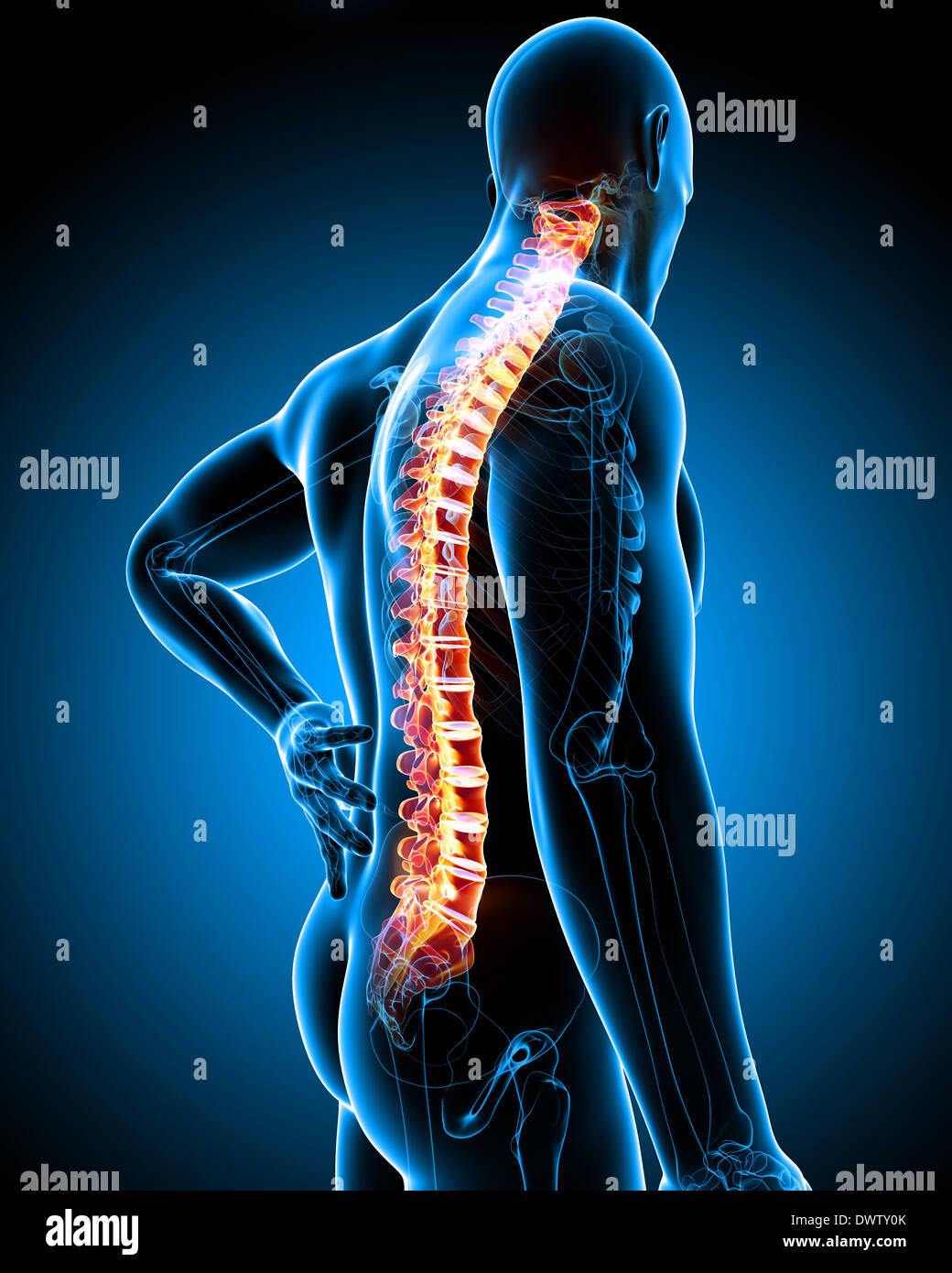 Back pain man drawing Stock Photo Alamy