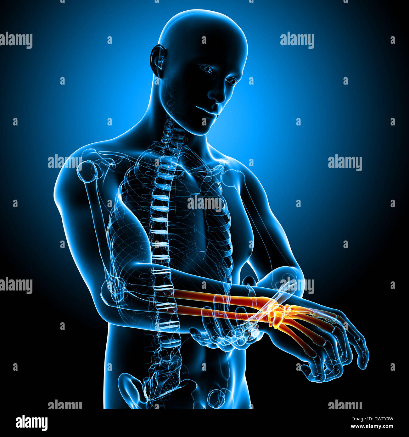 Wrist pain man drawing Stock Photo Alamy