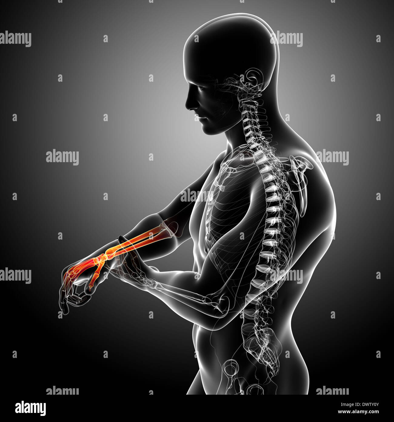 Wrist Pain Man Drawing Stock Photos & Wrist Pain Man Drawing Stock