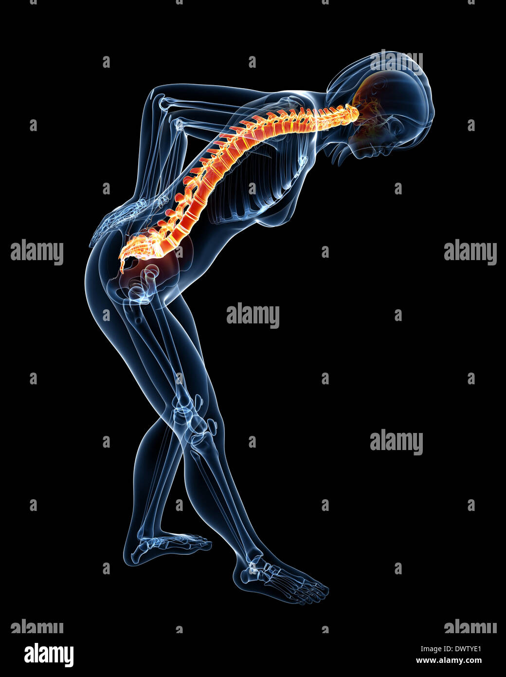 Back Pain Woman Drawing Stock Photo Alamy