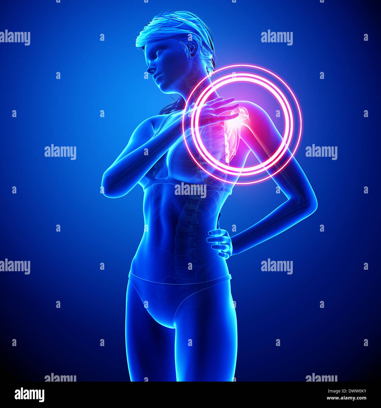 Shoulder pain woman drawing Stock Photo - Alamy