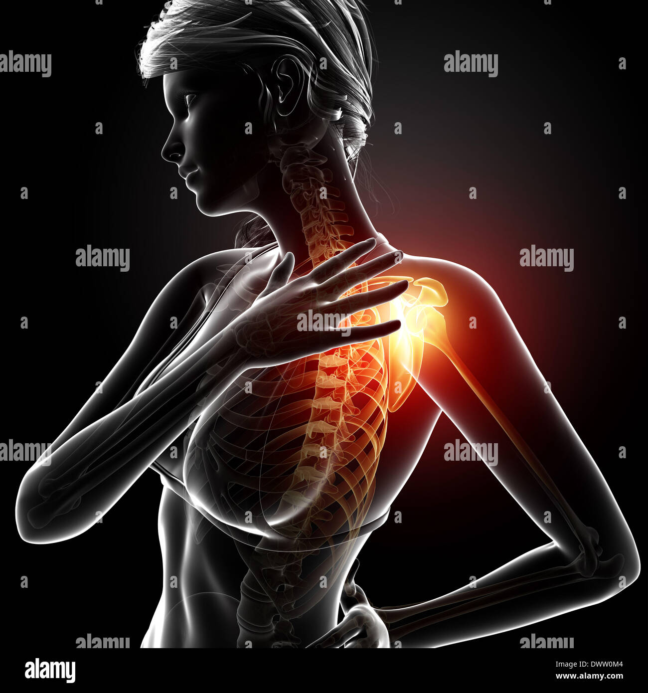 Shoulder pain woman drawing Stock Photo - Alamy