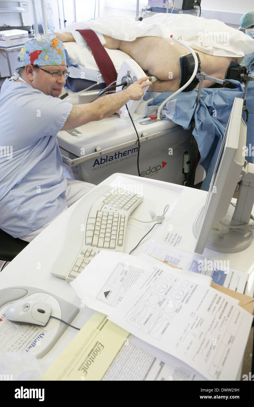 Cancer prostate ablatherm Stock Photo - Alamy
