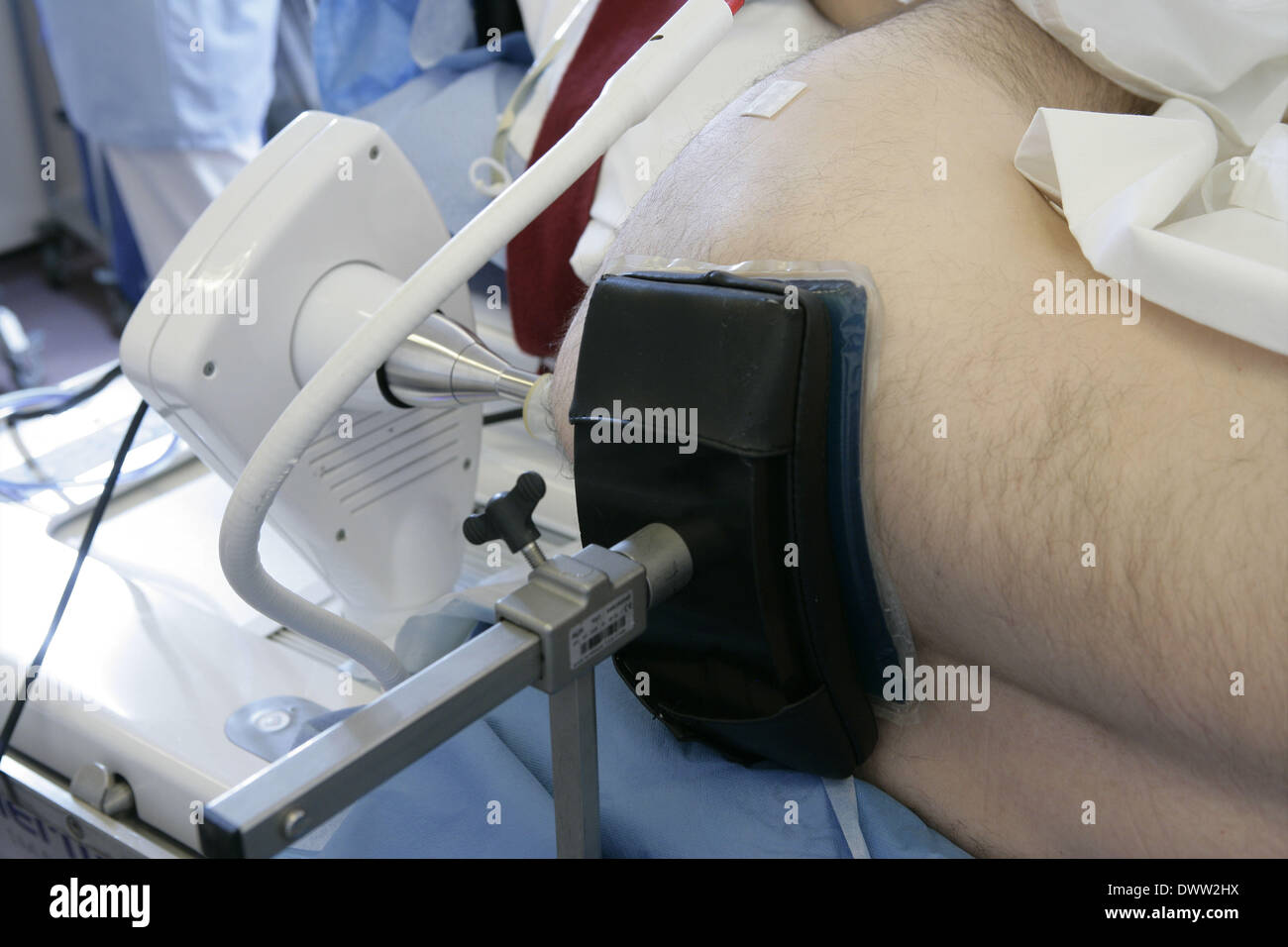 Cancer prostate ablatherm Stock Photo - Alamy