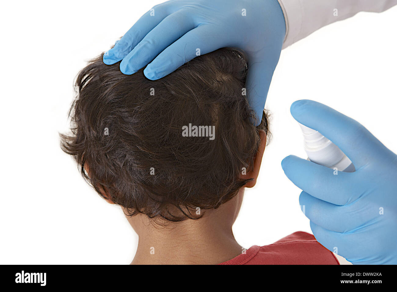 Treatment anti lice Stock Photo Alamy