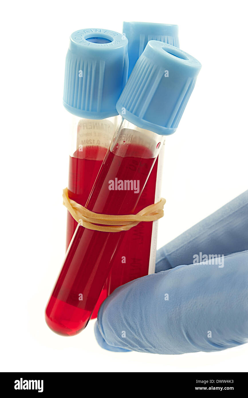 Blood sample collection tube Cut Out Stock Images & Pictures Alamy
