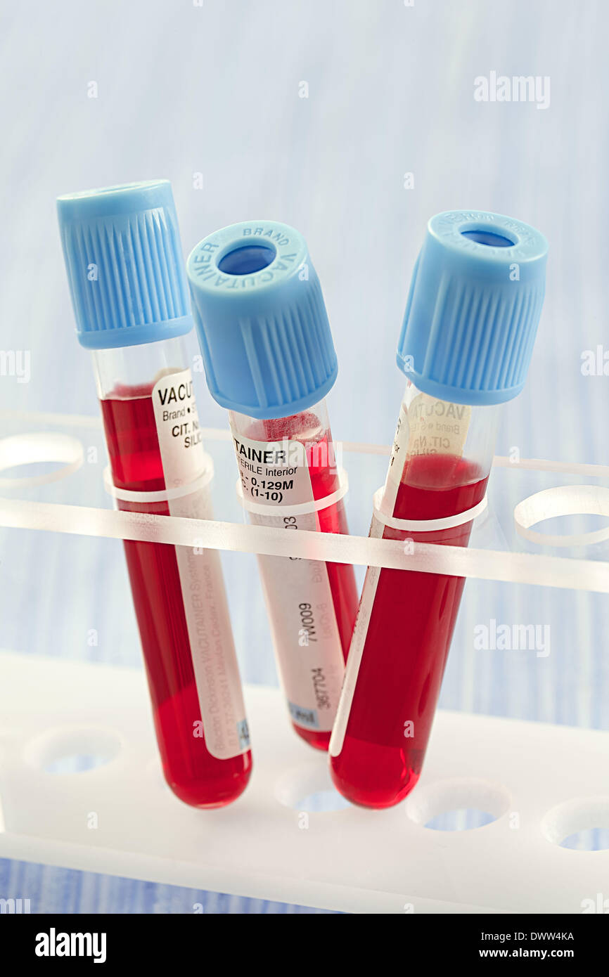 Blood specimen hires stock photography and images Alamy