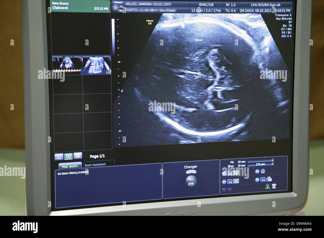 Pregnant woman ultrasound scan Stock Photo Alamy