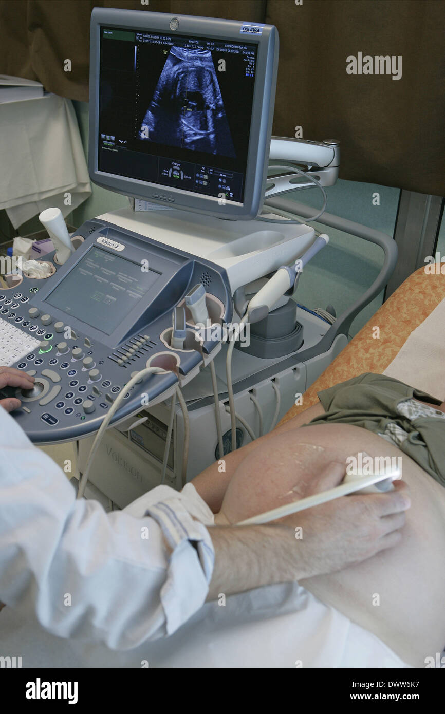 Pregnant woman ultrasound scan Stock Photo - Alamy