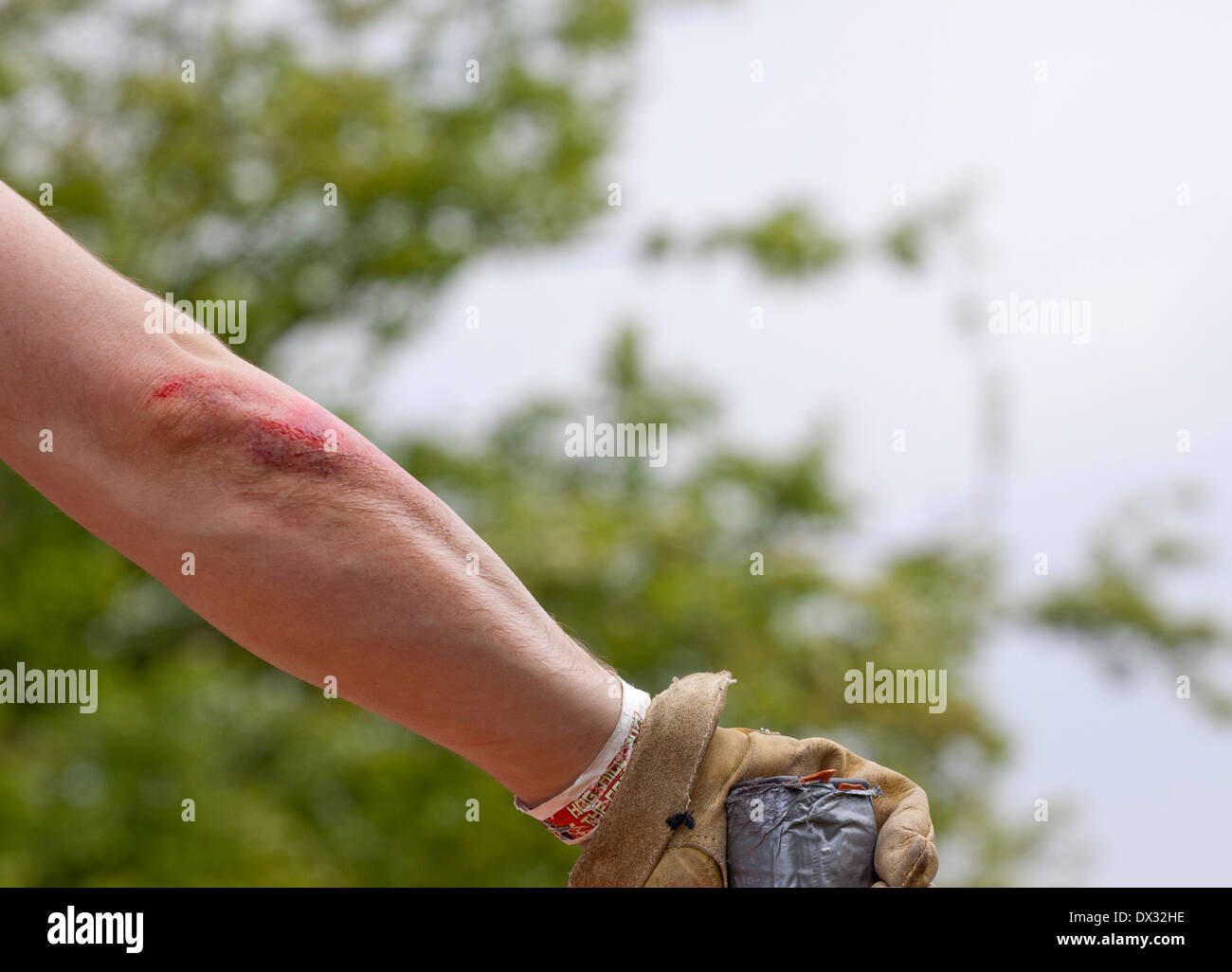 Grazed Injury High Resolution Stock Photography and Images Alamy