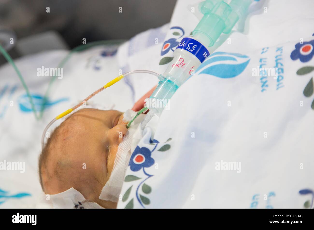 Wolfson Hospital in Holon, Israel: Palestinian Baby in Intensive Care Unit, taken care of by Israeli volunteers of 'Save a Child's Heart Pictured 21.02.2014 Stock Photo