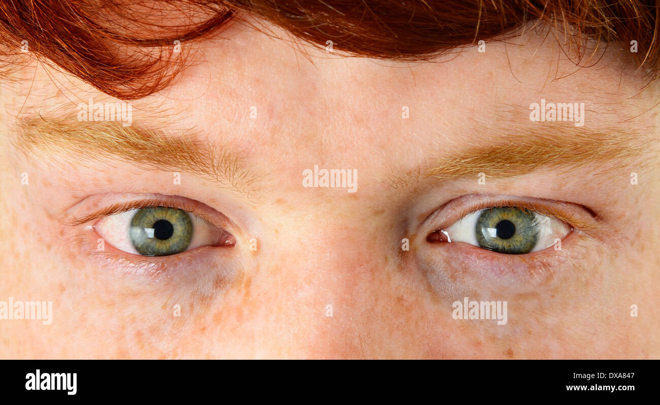 Young man with red hair, freckles and green eyes Stock Photo