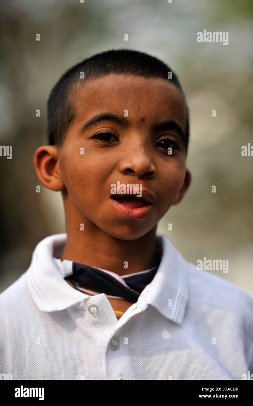 Dhaka, Bangladesh. 21st Mar, 2014. A Down syndrome Tamanna age of 11 in