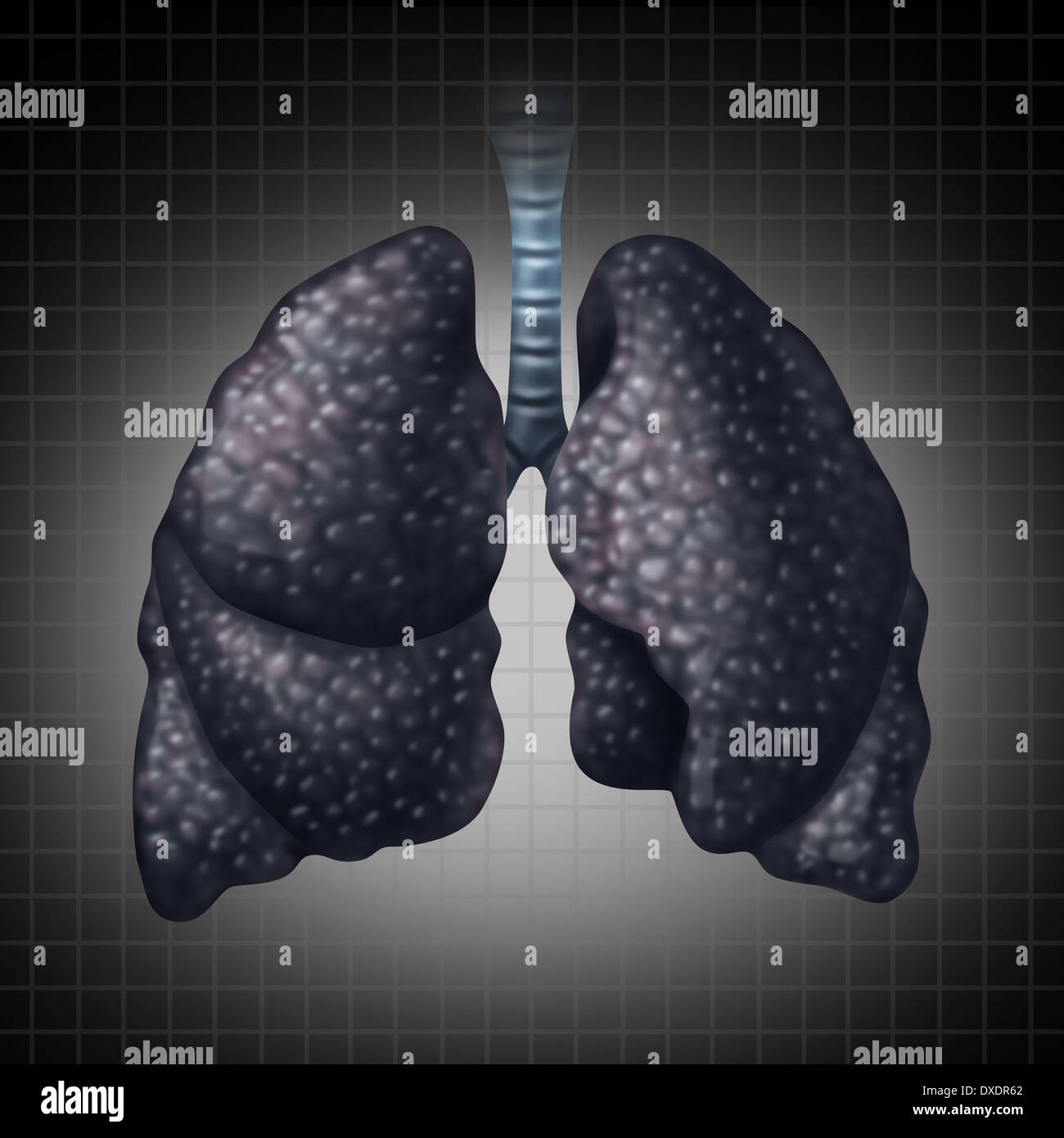 Collapsed lung hires stock photography and images Alamy
