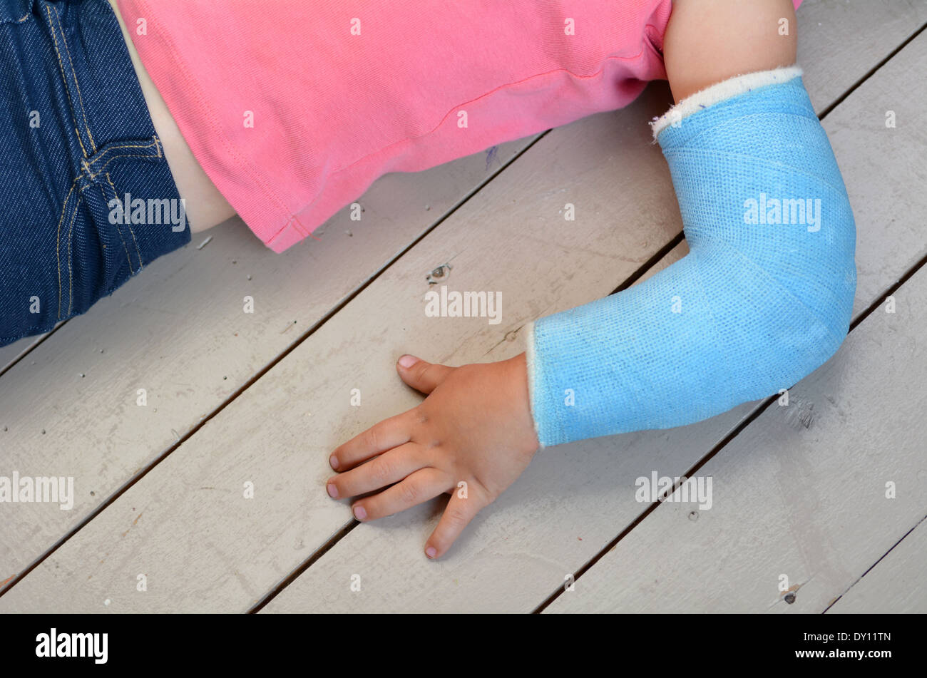Child with a broken arm wearing a cast. Concept photo of child Stock Photo  - Alamy