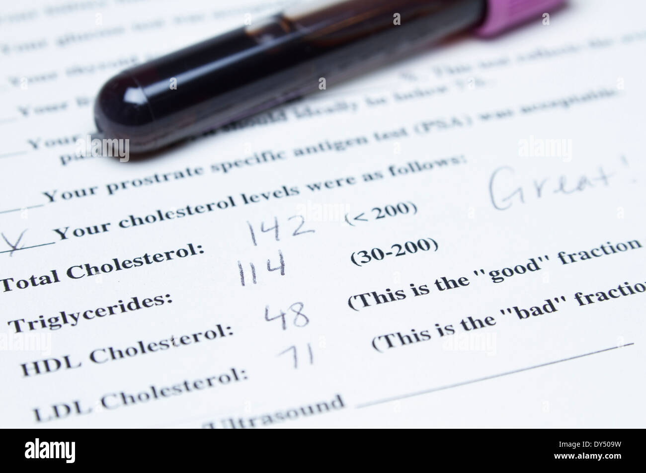 Test tube filled with blood and cholesterol test form document Stock Photo Alamy