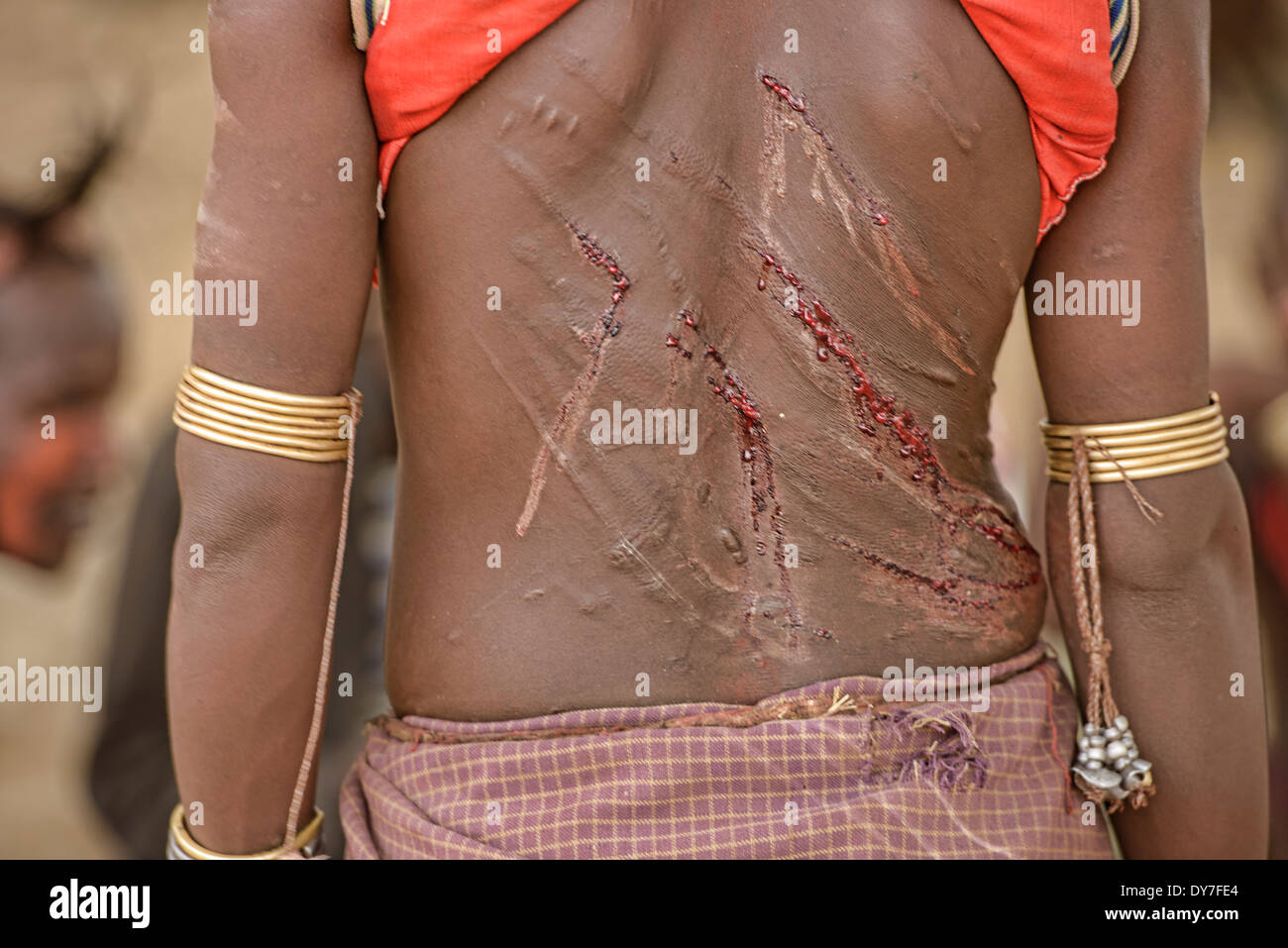 Hamer woman's back after being whipped at a bull jumping ceremony ...