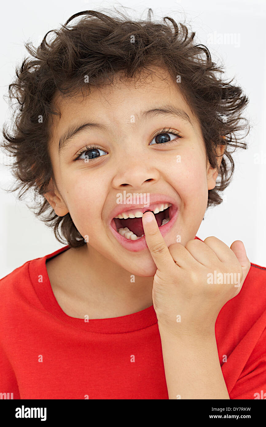 Mixed dentition hi-res stock photography and images - Alamy
