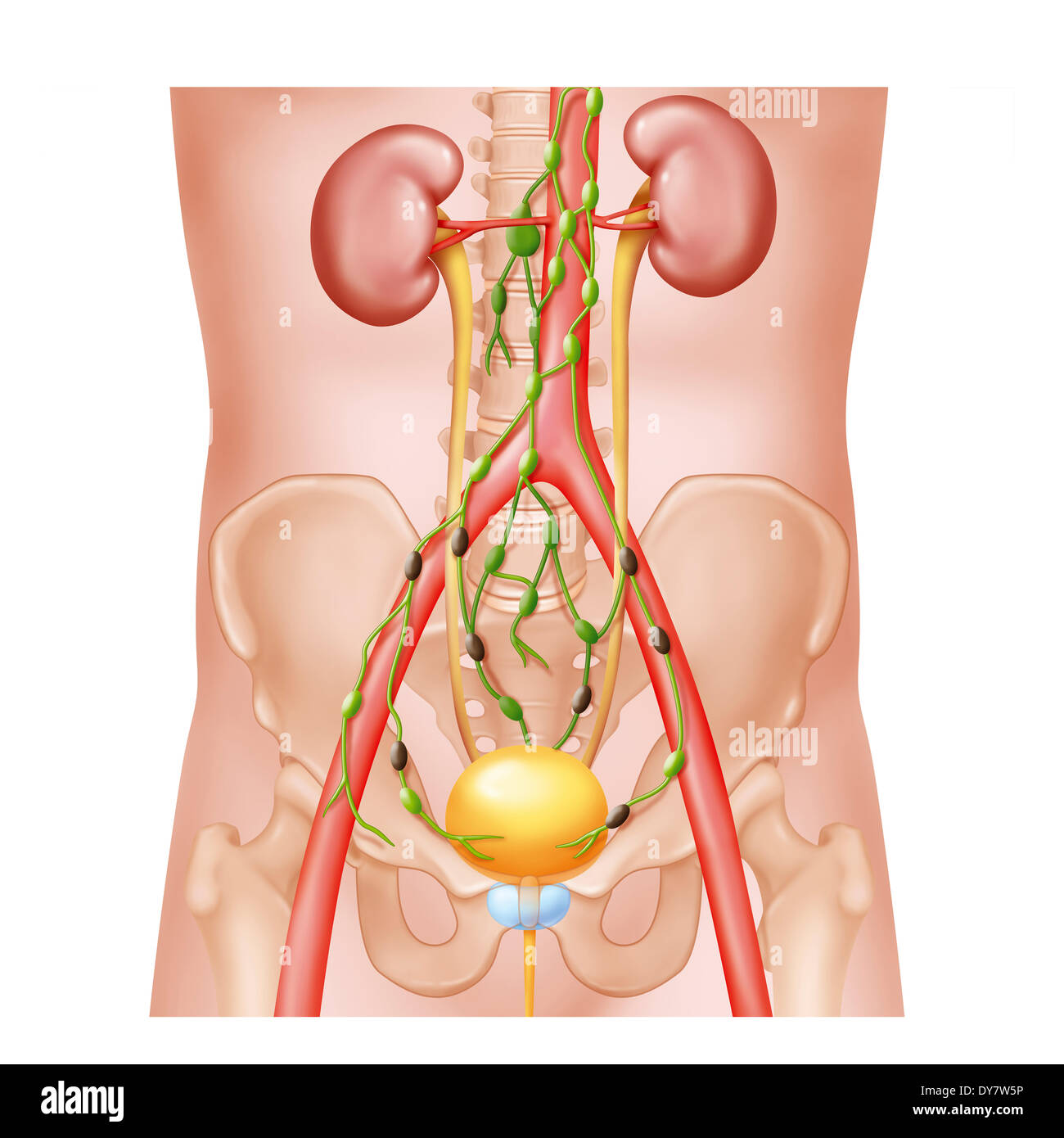 Metastasis, drawing Stock Photo