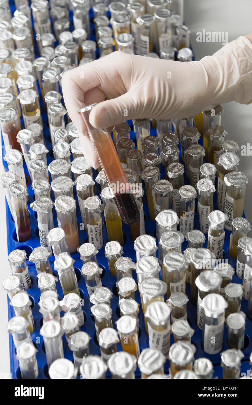 Test tubes with samples in a medical laboratory, Germany Stock Photo