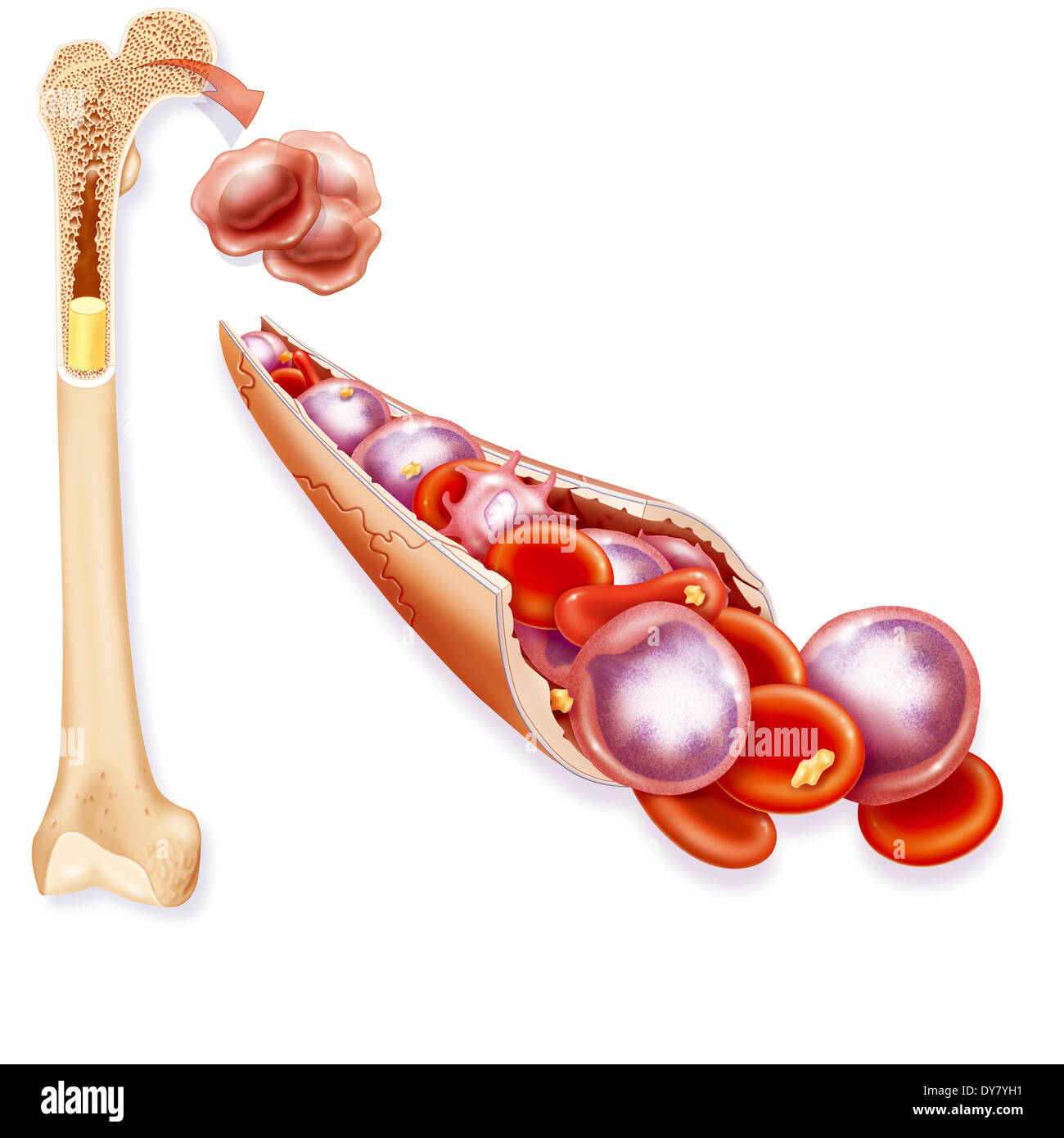 Leukemia drawing Stock Photo