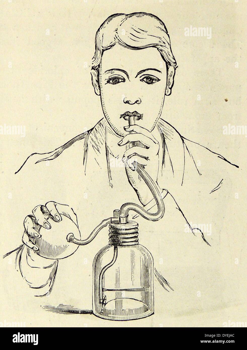 Bronchitis patient using an atomiser to relieve shortness of breath