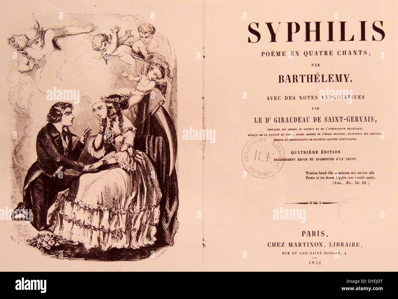 Syphilis : poëme en quatre chants (1851) by Barthélemy, 1796-1867; Fracastoro, Girolamo, 1478-1553. The history of syphilis has been well studied, but the exact origin of syphilis is unknown. There are two primary hypotheses: one proposes that syphilis was carried from the Americas to Europe by the crew of Christopher Columbus, the other proposes that syphilis previously existed in Europe but went unrecognized Stock Photo