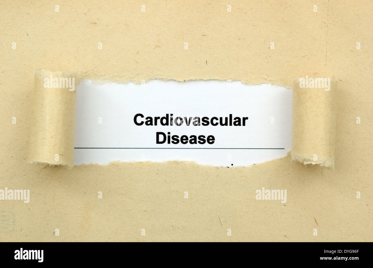 Cardiovascular disease text Stock Photo - Alamy
