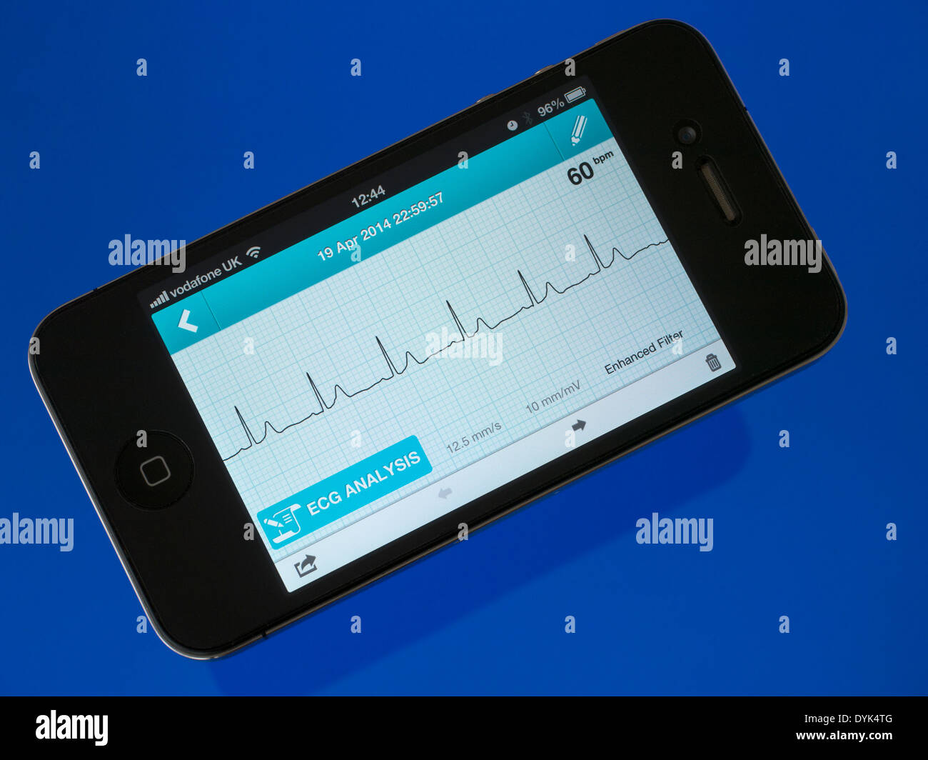 Portable ECG EKG Heart Monitor App running on iPhone 4 showing normal sinus heart rhythm trace. Stock Photo