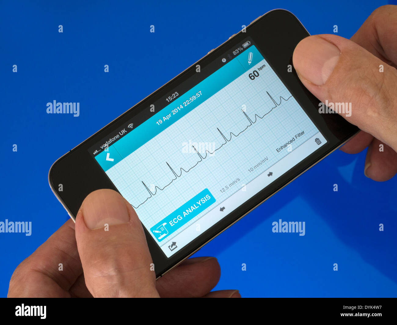 User holding portable ECG EKG Heart Monitor App running on iPhone 4 with trace showing normal sinus heart rhythm trace. Stock Photo