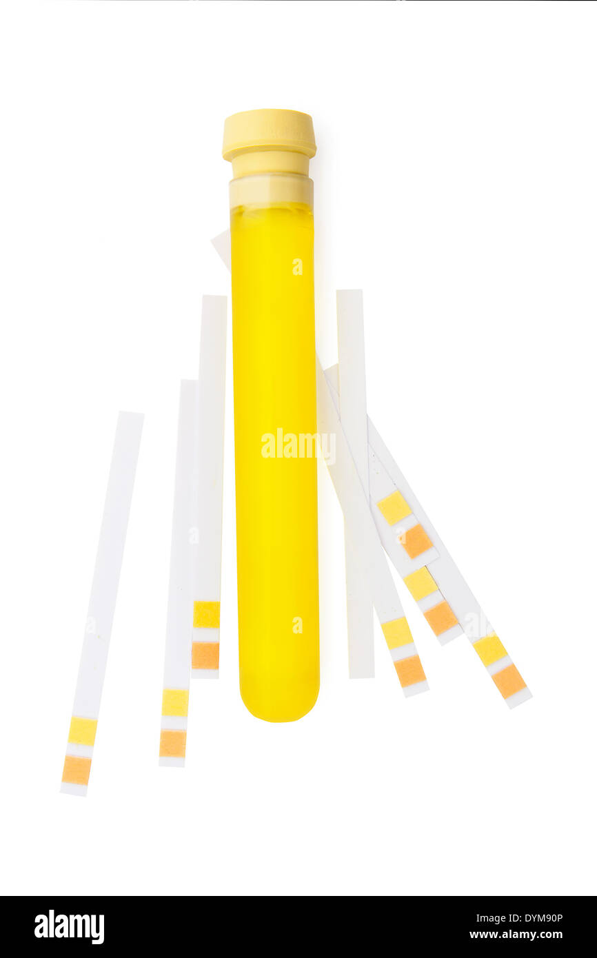 pH litmus test strip and urine in test tube isolated on white