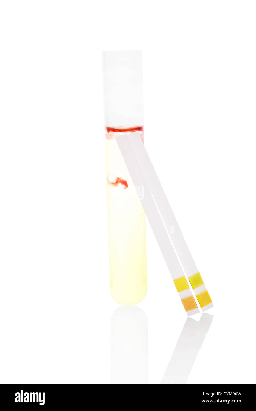 Urine sample with blood in test tube and pH litmus paper test strips