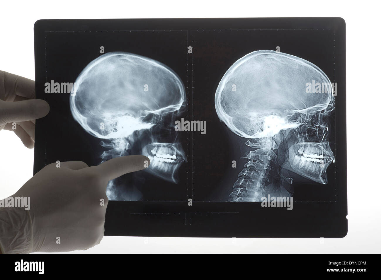 Doctor examining xrays in hospital Stock Photo Alamy