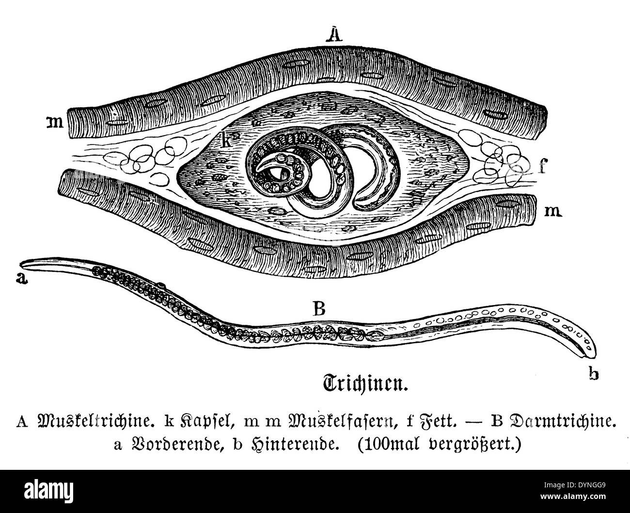 Trichinella hires stock photography and images Alamy