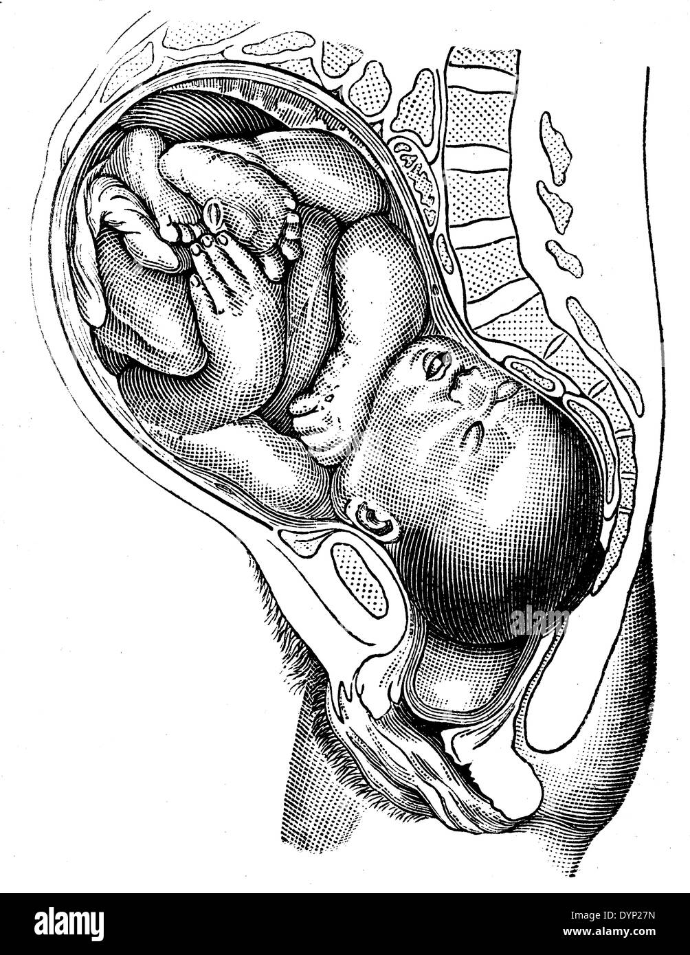 Fetal position in womb, illustration from Soviet encyclopedia, 1927 Stock Photo