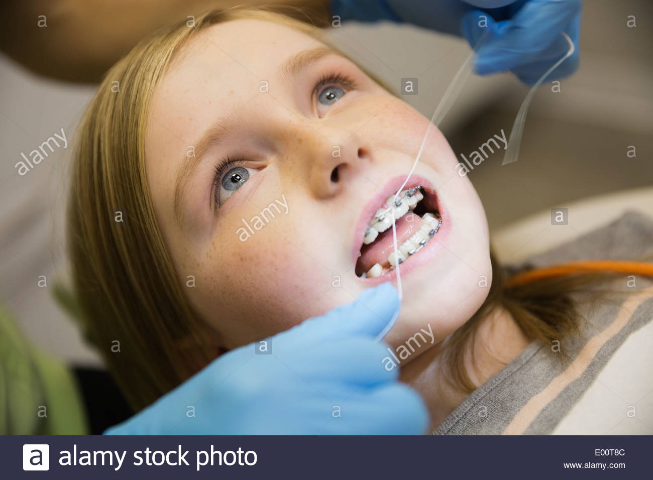 Dental assistant flossing between girls braces Stock Photo