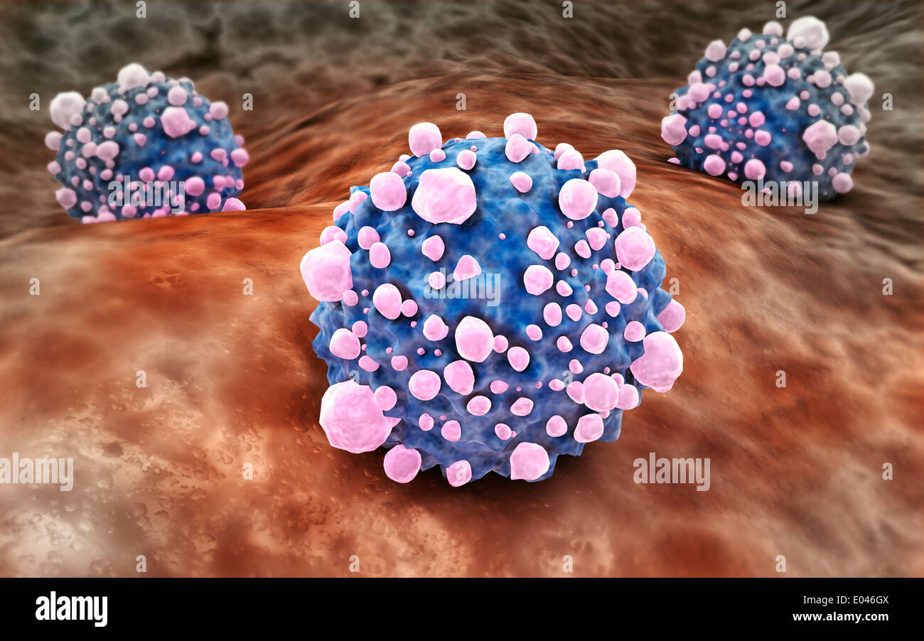 Microscipic view of pancreatic cancer cells. Stock Photo
