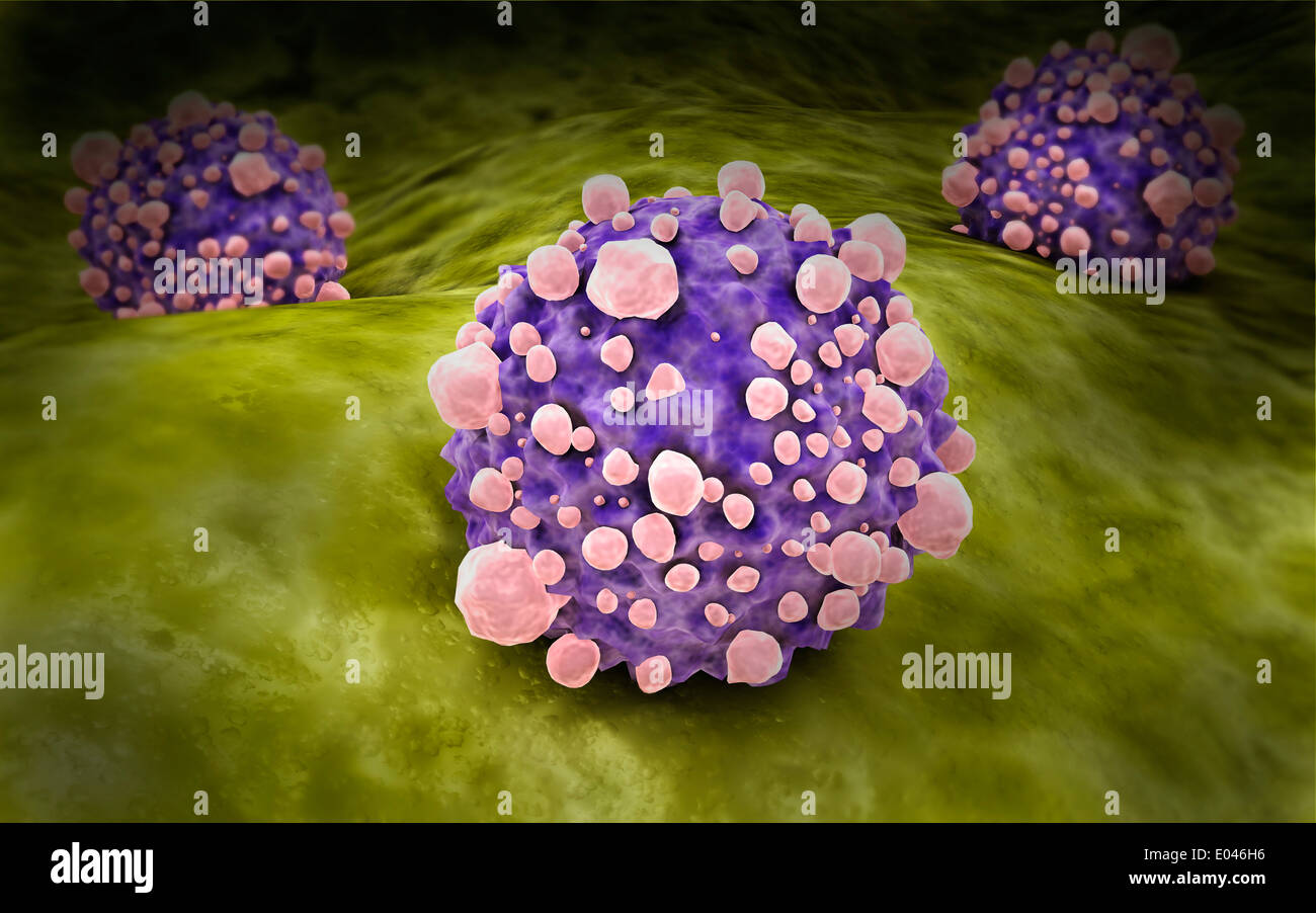 Microscipic view of pancreatic cancer cells. Stock Photo