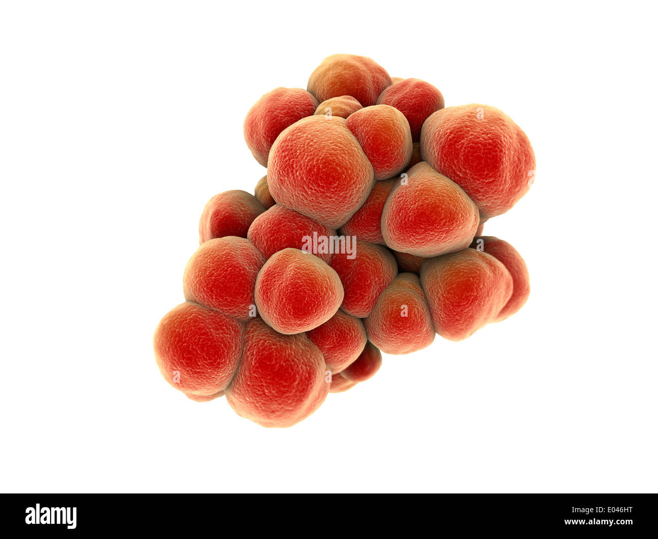 Microscopic view of tumor. Stock Photo