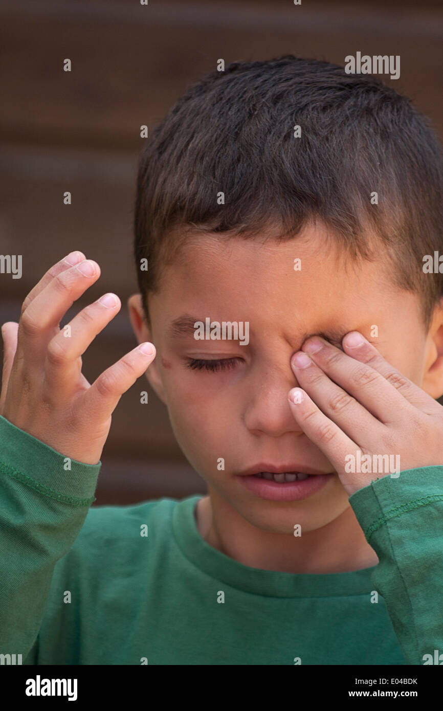 little boy with something in eye Stock Photo
