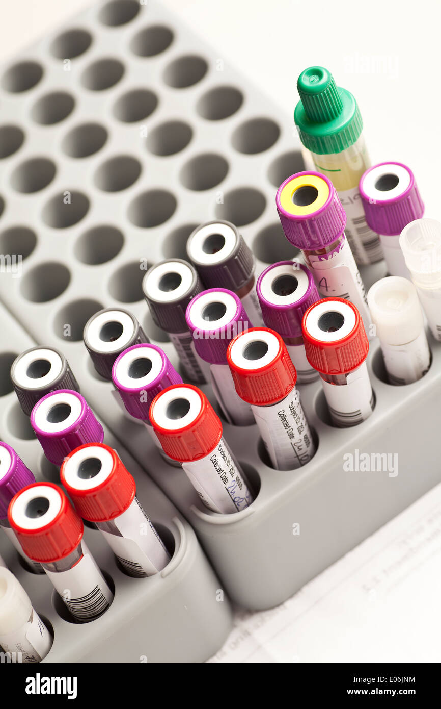 Blood sample in laboratory samples tray Stock Photo Alamy