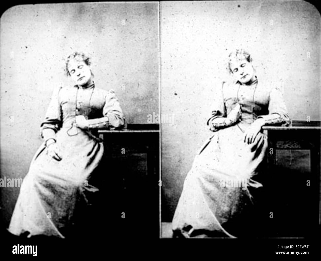 A photograph illustrating the process of contracture transfer using magnets, highlighting a medical or therapeutic technique in the early 20th century. Stock Photo