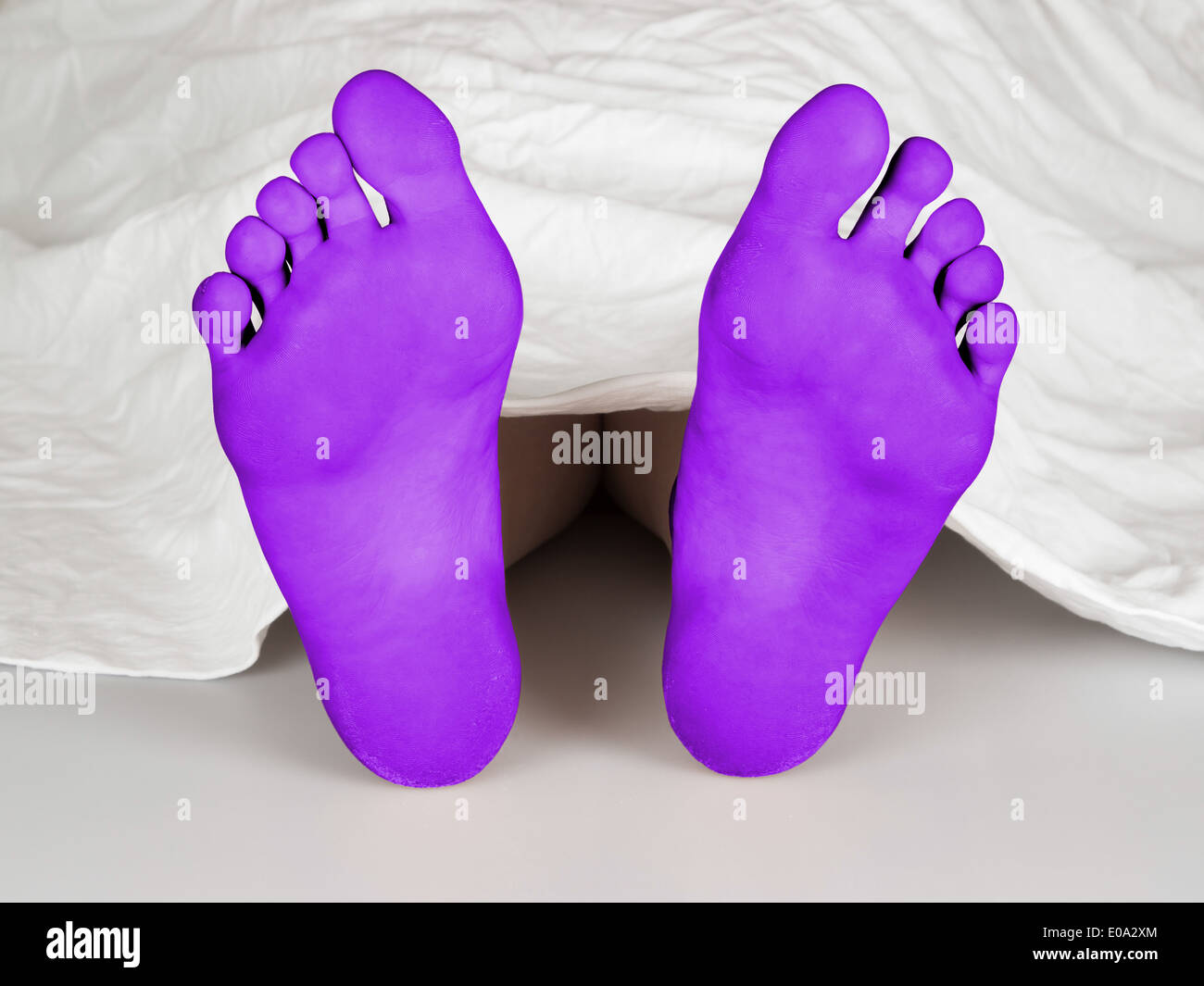 Почему нога фиолетовая. Фиолетовые ноги. Синие ступни. Стопа фиолетовая.
