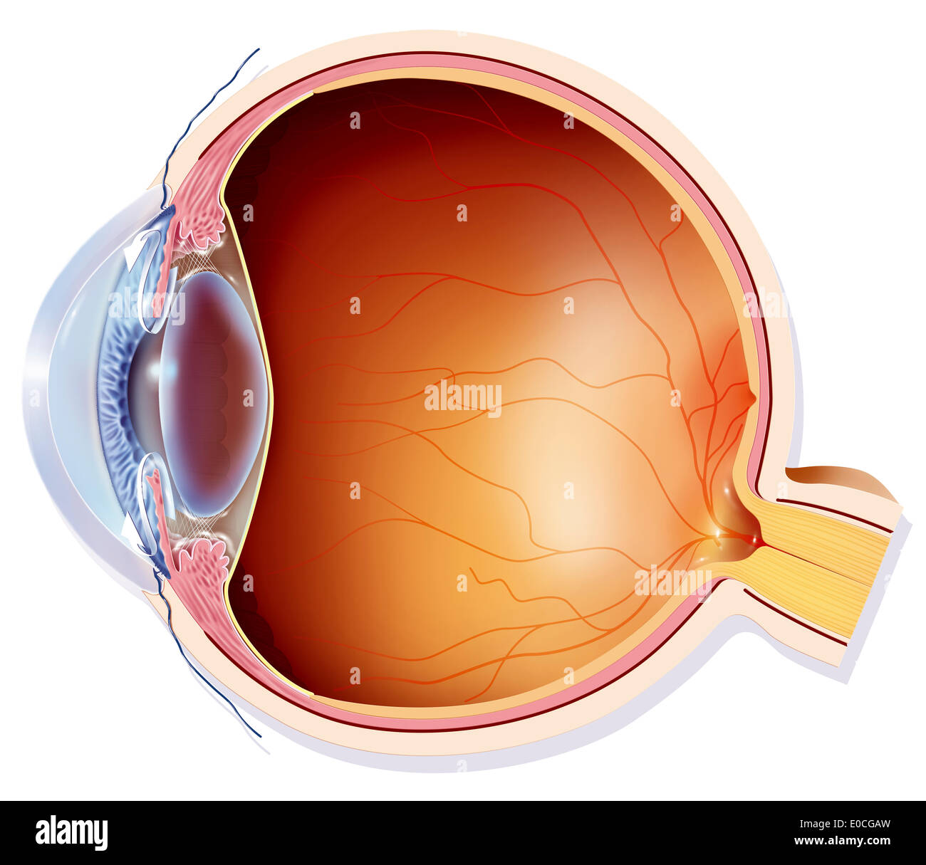 Glaucoma, drawing Stock Photo