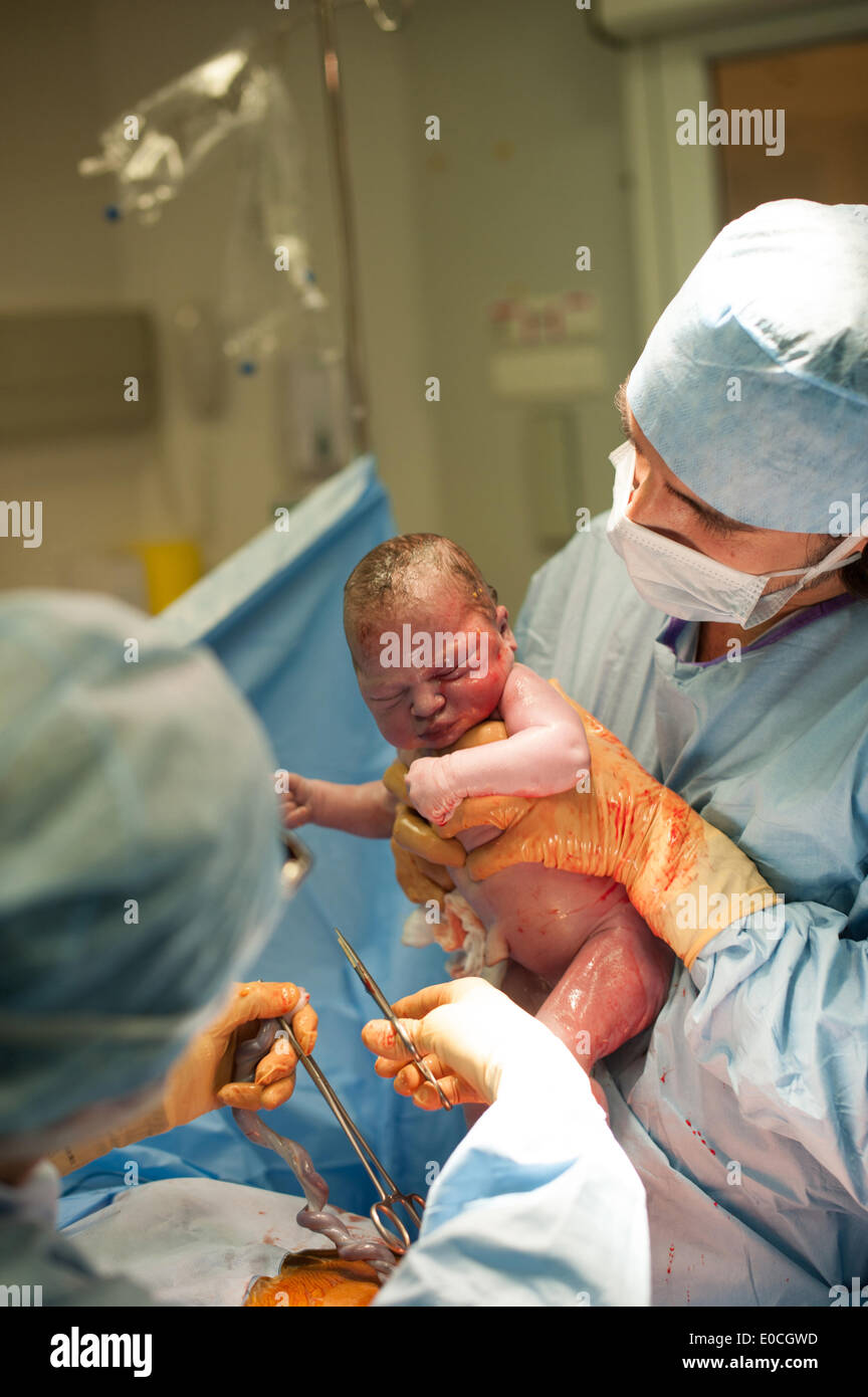 Cesarean birth Stock Photo