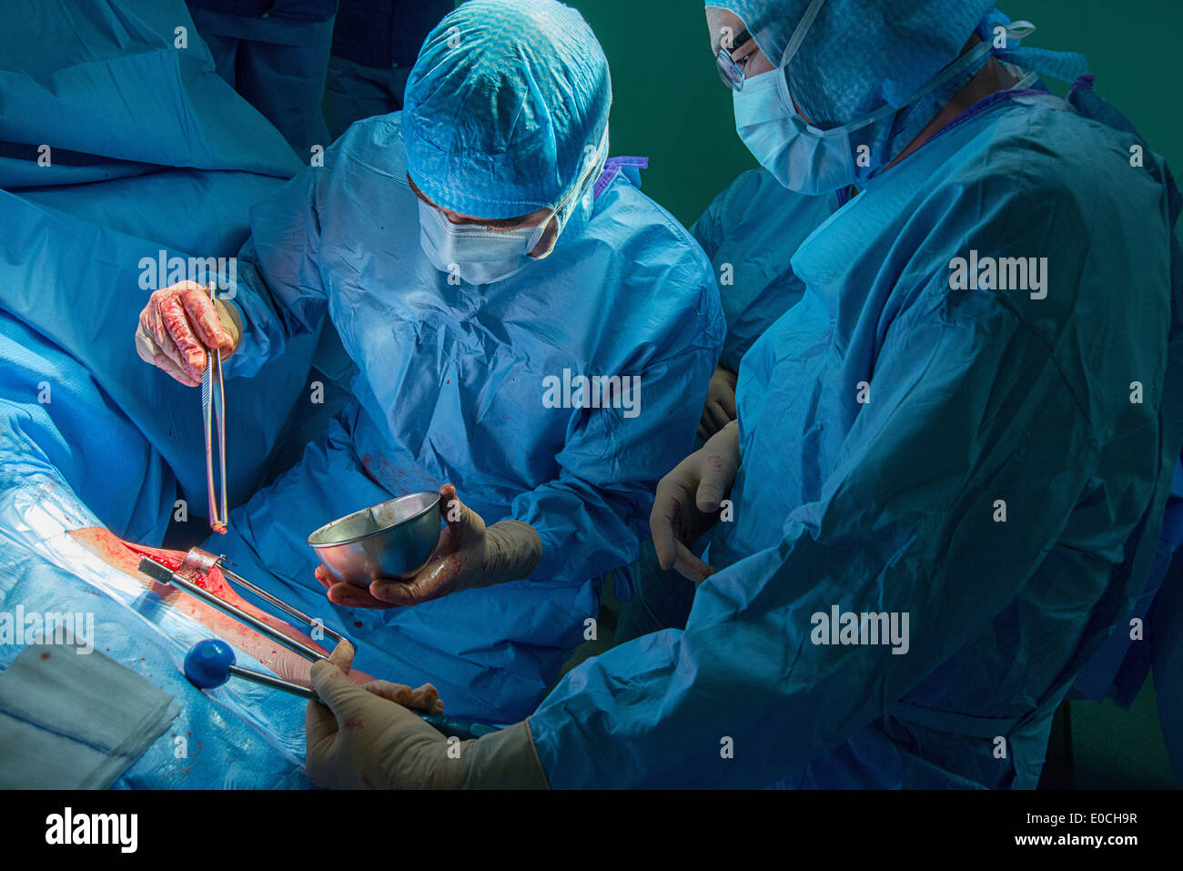 Hip prosthesis, surgery Stock Photo